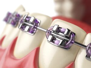 35802 Orthodontist