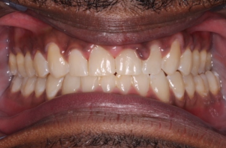 after Image