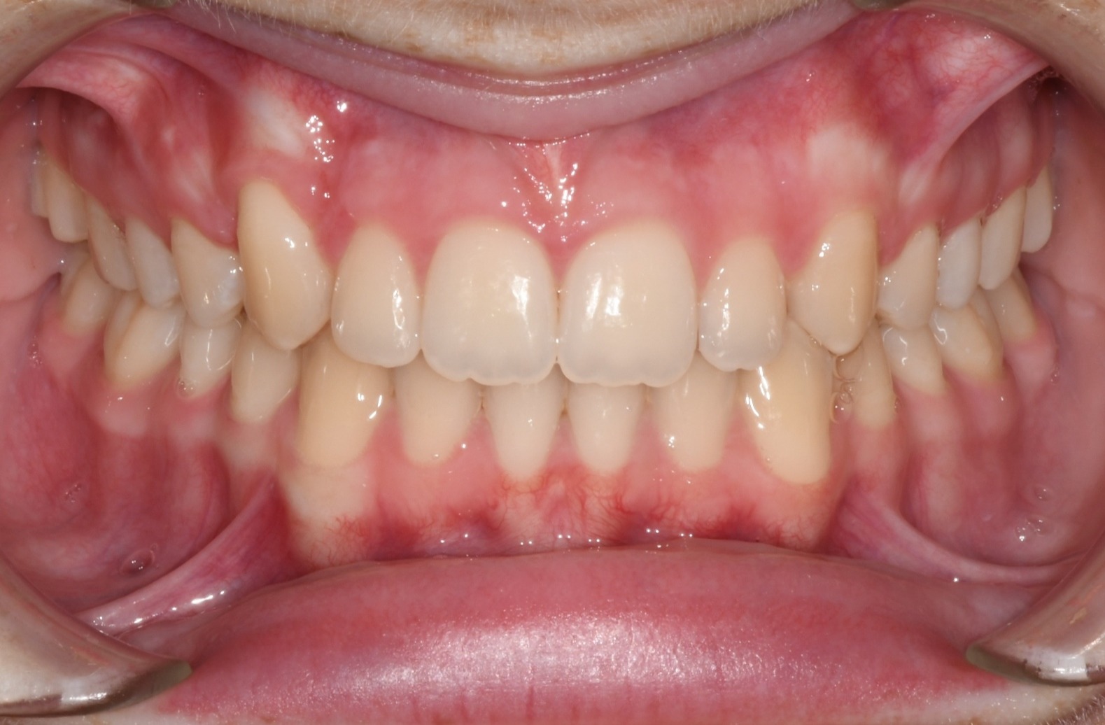 after Image