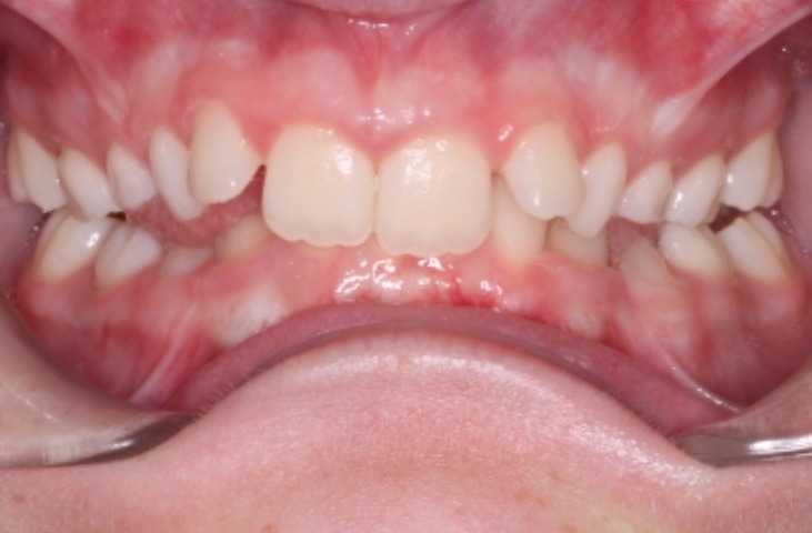 before Image