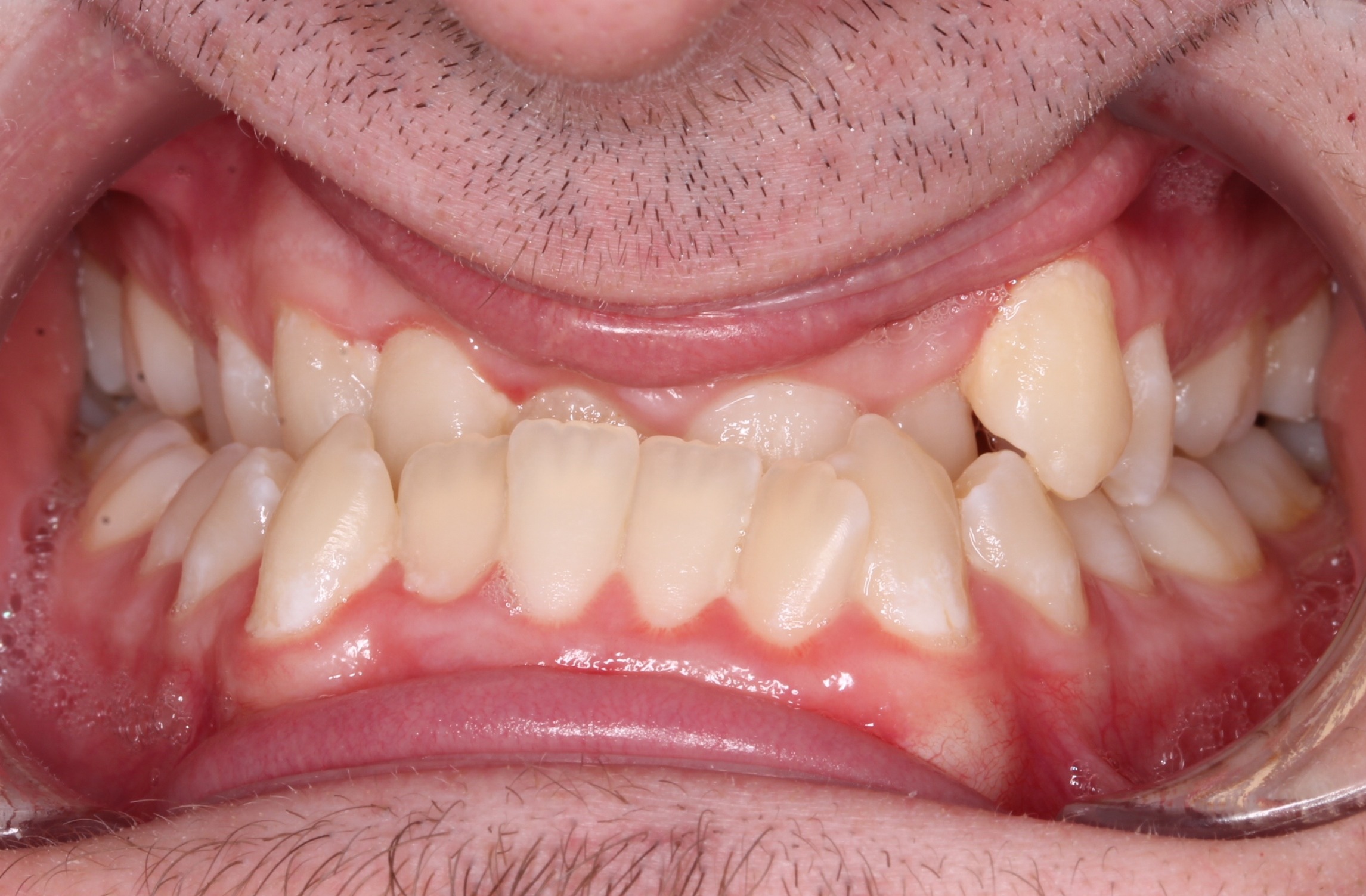 before Image