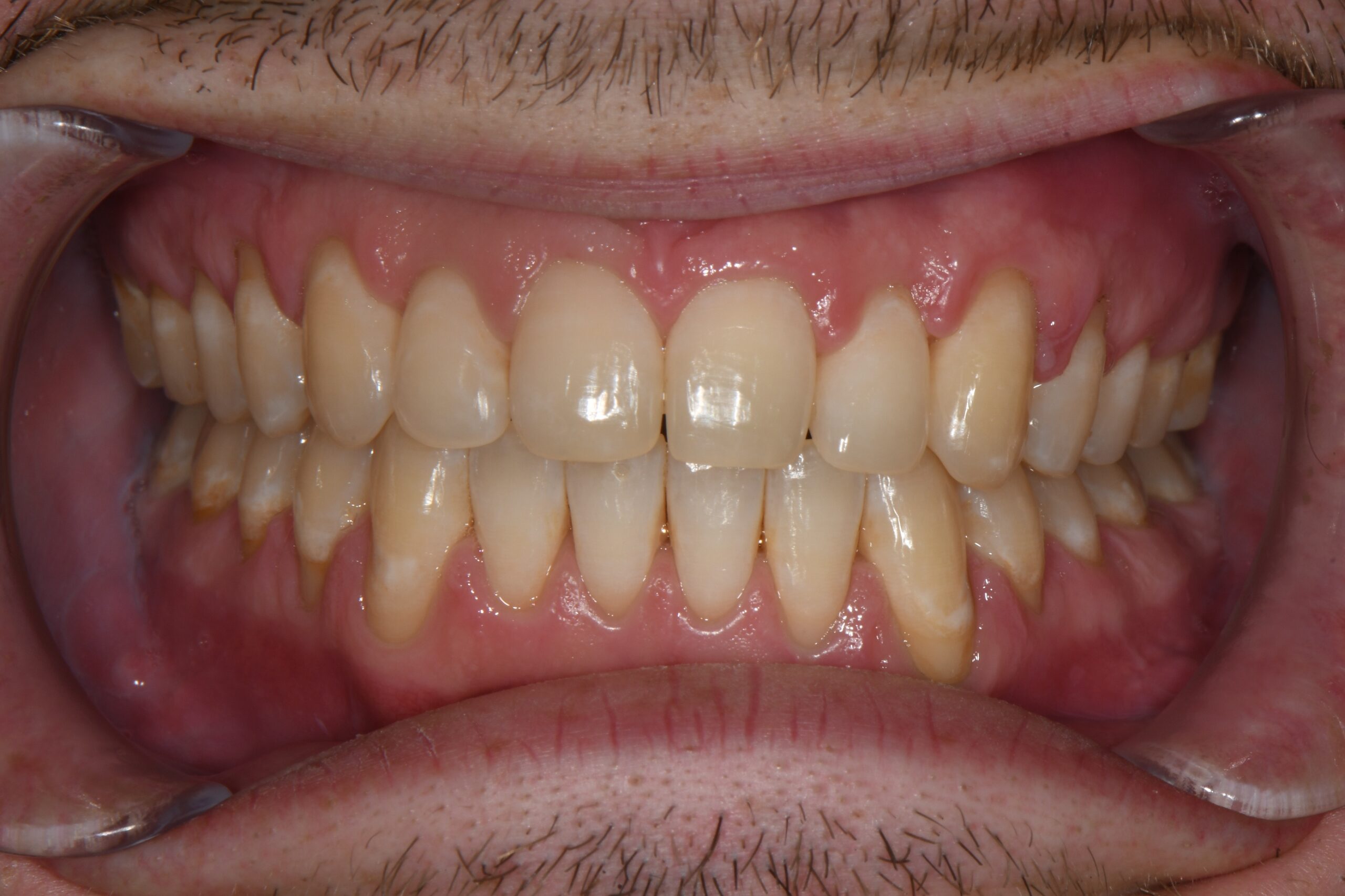 after Image